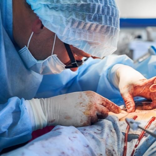 Angioplasty