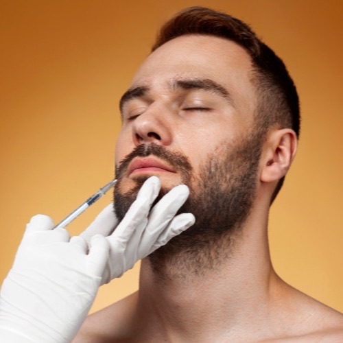 Beard Transplant