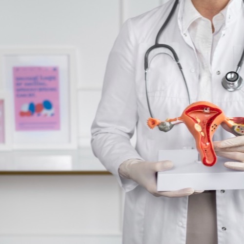 IUI Treatment