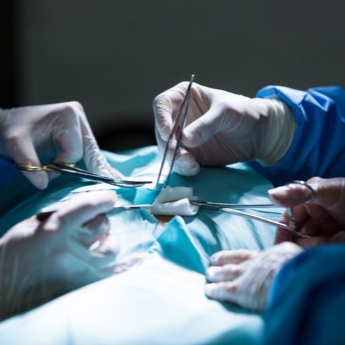 Liver Transplant
