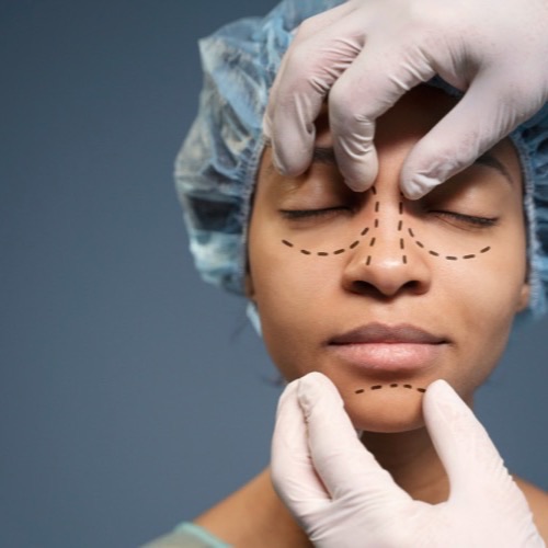 Rhinoplasty