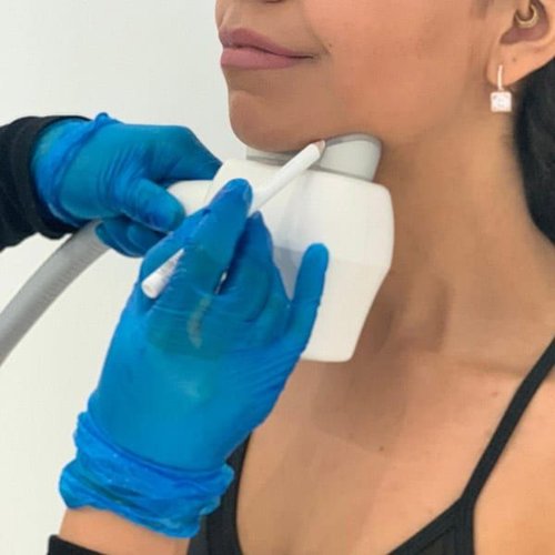 Double Chin Reduction