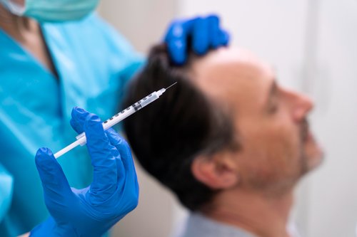 Hair Fall PRP Therapy