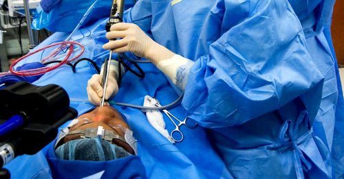 FESS (Endoscopic Sinus Surgery)