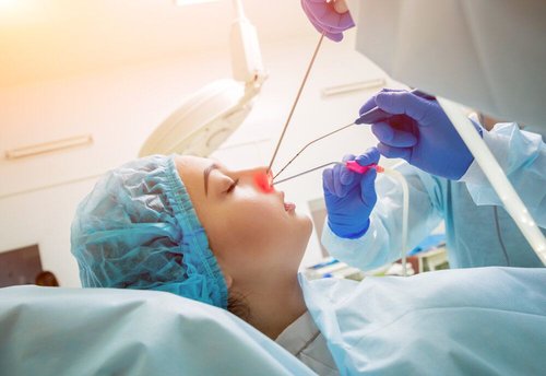 Nasal Obstruction