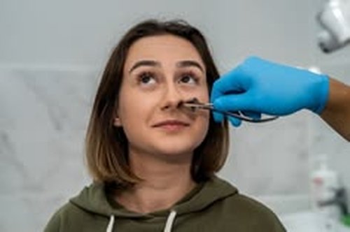 Nasal Polypectomy