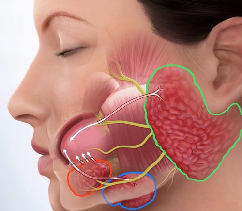 Parotidectomy