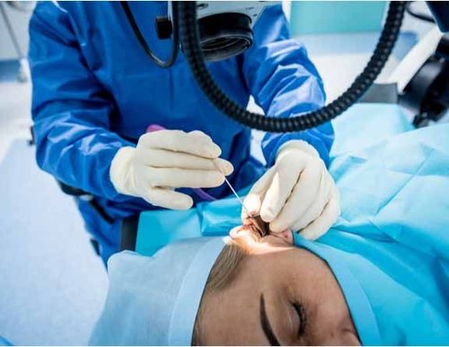 Tympanoplasty