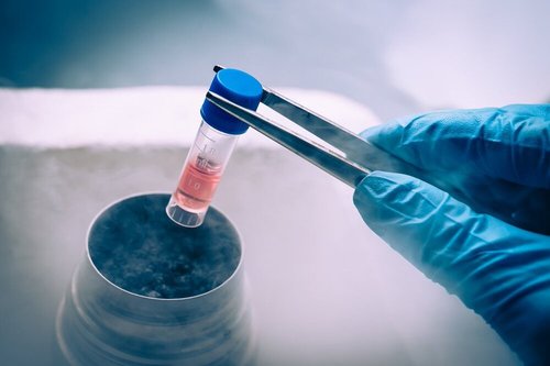 Fertility Preservation