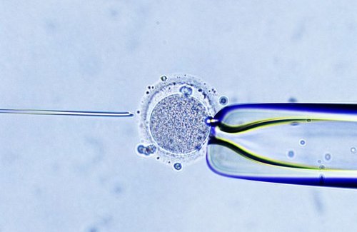 ICSI (Intracytoplasmic Sperm Injection)