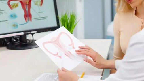 Ovulation Induction