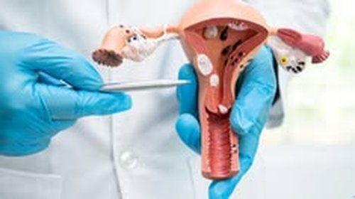 Vaginoplasty