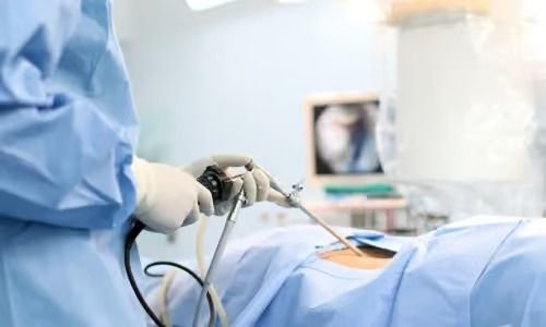 Gallbladder Removal (Cholecystectomy)