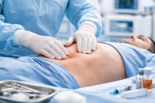 Hernia Repair