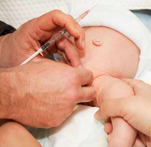 Laser Circumcision