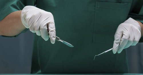 Stapler Circumcision