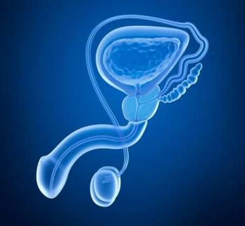 Testicular Torsion
