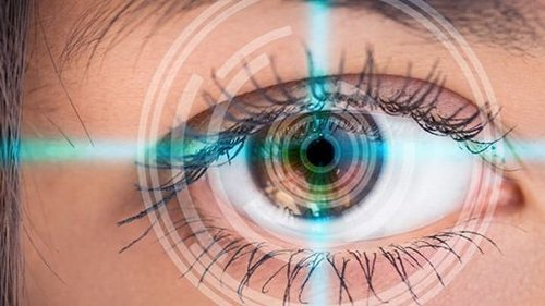 Femtosecond Laser Cataract Surgery