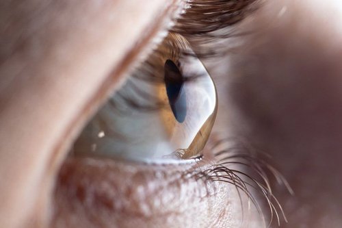 Keratoconus Treatment