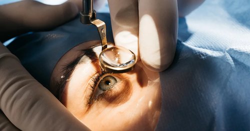 Multifocal Lens Implant