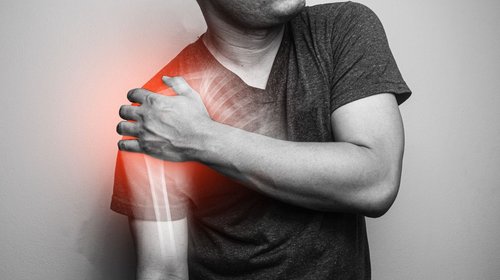 Shoulder Dislocation