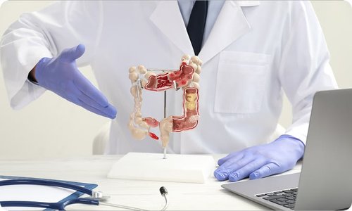 Laser Hemorrhoidoplasty
