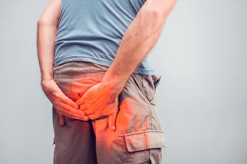 Piles (Hemorrhoids)