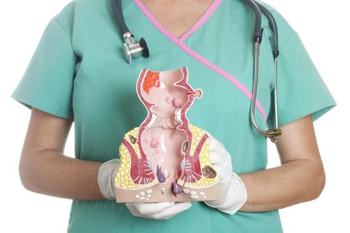 Rectal Prolapse