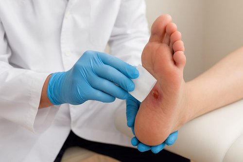 Diabetic Foot Ulcer Treatment
