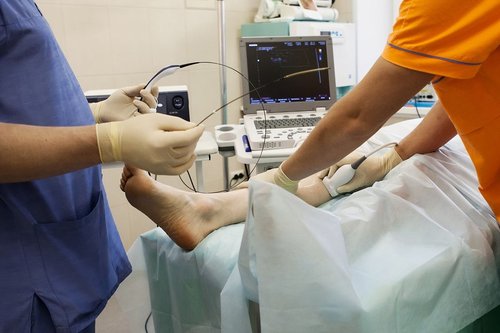 Radiofrequency Ablation (Varicose Veins)