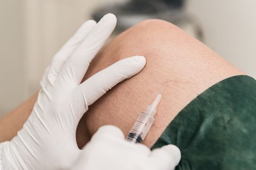 Sclerotherapy