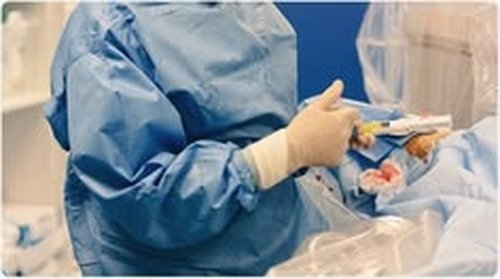 Uterine Fibroid Embolisation
