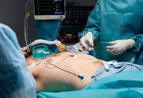 Gastric Bypass Surgery