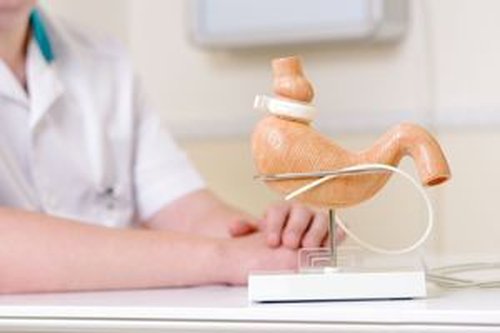 Revision Bariatric Surgery